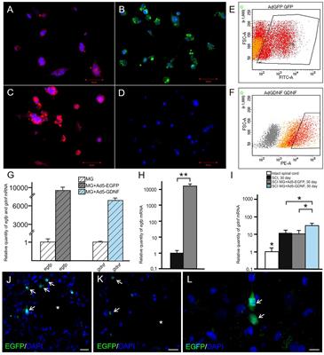 Transplantation of Microglia in the Area of Spinal Cord Injury in an Acute Period Increases Tissue Sparing, but Not Functional Recovery